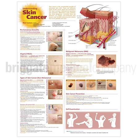 Laminated Chart - Understanding Skin Cancer - Briggate Medical Company