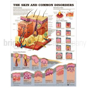 Laminated Chart - The Skin and Common Disorders