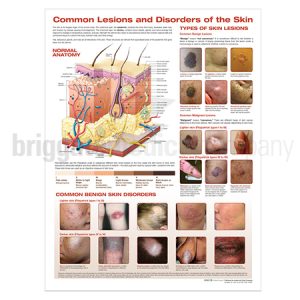 Laminated Chart - Common Lesions & Skin Disorders