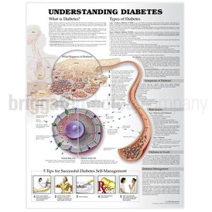 Laminated Chart - Understanding Diabetes