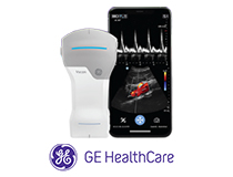 Diagnostic Ultrasound