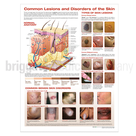 Laminated Chart - Common Lesions & Skin Disorders