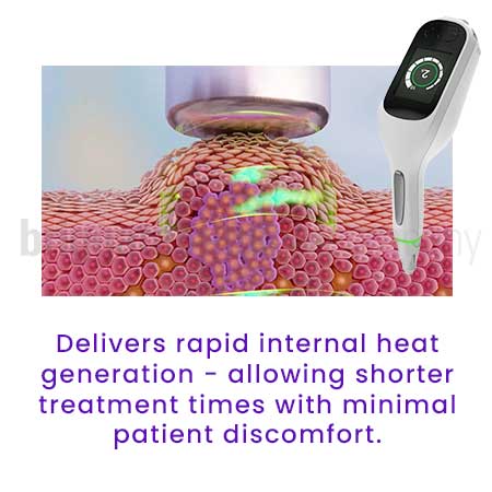 SwiftPro Handheld Battery-Operated Microwave Therapy Generator - Image 2