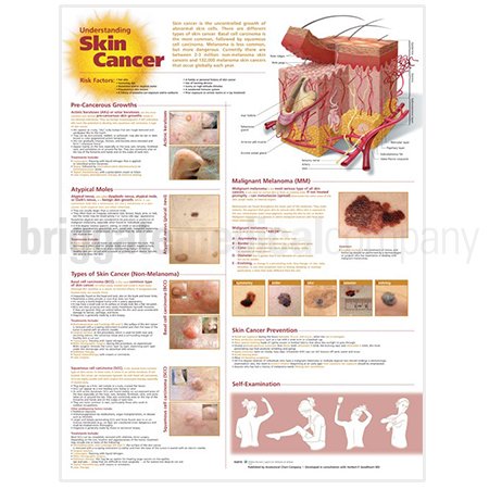 Laminated Chart - Understanding Skin Cancer