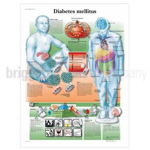 Laminated Chart - Diabetes Mellitus